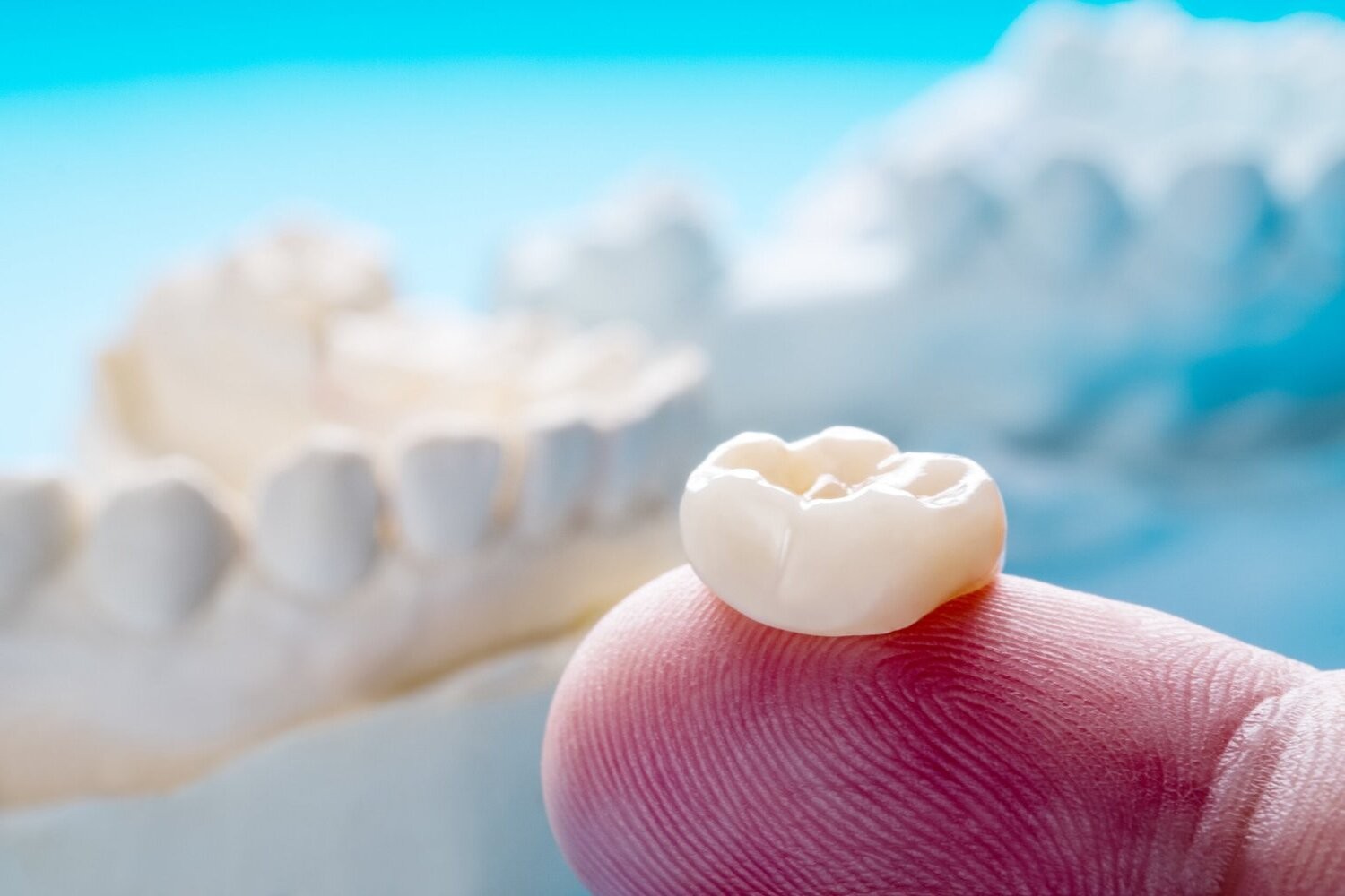 Crown has come off tooth