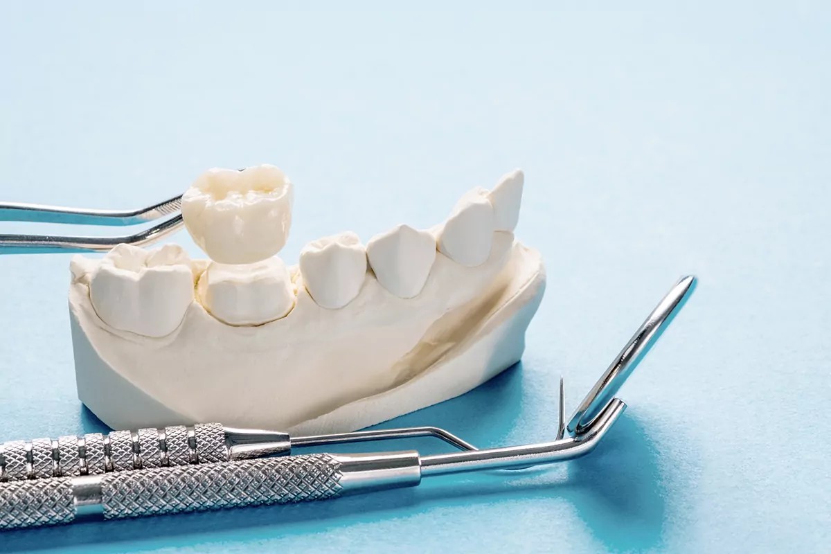 Zirconia crowns pros and cons